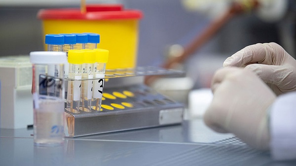 Магазини, ресторани, заклади побутового обслуговування м. Києва повинні тестувати працівників на COVID-19 Магазини, ресторани, заклади побутового обслуговування м. Києва повинні тестувати працівників на COVID-19